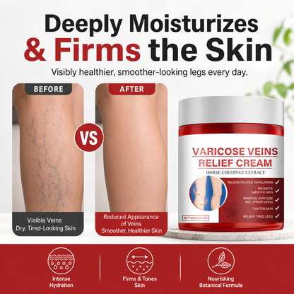 Varicose Veins Cream for Legs